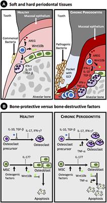 CD8+ T Cells in Chronic Periodontitis: Roles and Rules